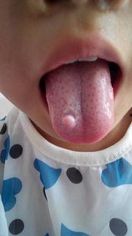 吃小白瓜舌头烂了,小白瓜引发舌头烂剧变